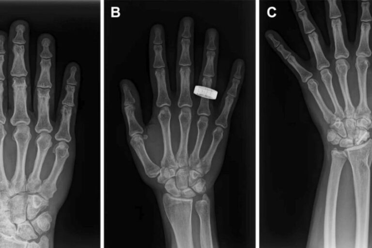 Un grupo de astronautas sin formación médica se ha hecho la primera radiografía en órbita del mundo: es un avance brutal